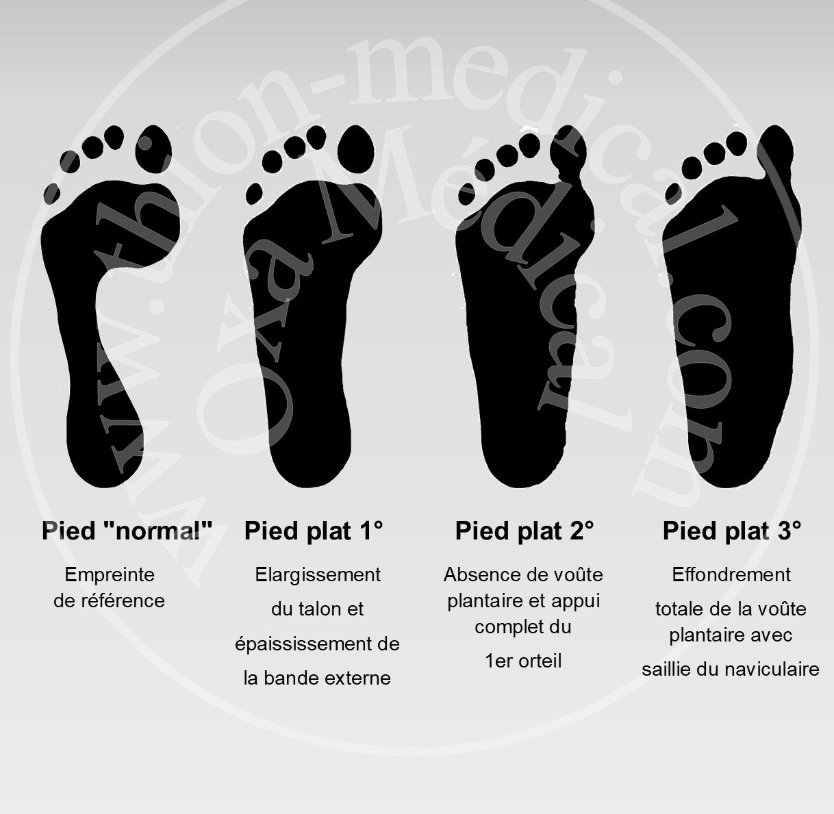 Empreintes pieds plats 3 degrés